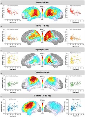 Aberrant age-related alterations in spontaneous cortical activity in participants with cerebral palsy